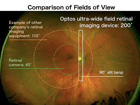 optomap retinal exam article